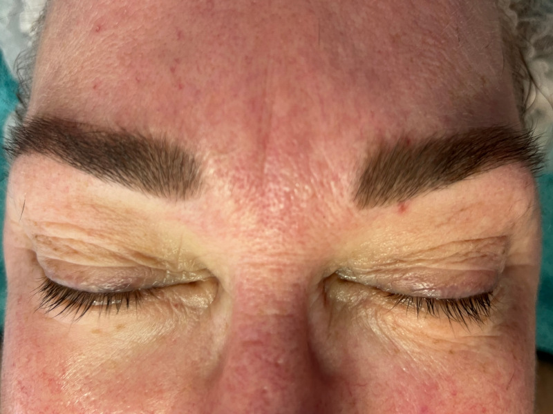 Wimpern efter