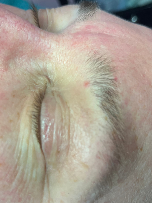Wimpern for