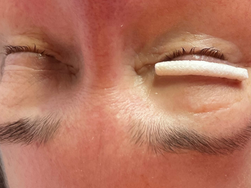 Wimpernrolle efter